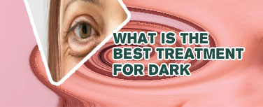 Dark eye bag trend