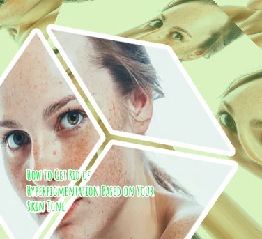 Pigmentation skin care